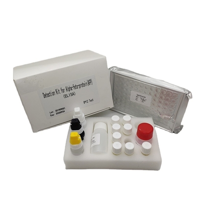Bộ phát hiện định lượng Alpha Fetoprotein Elisa AFP trong huyết thanh người