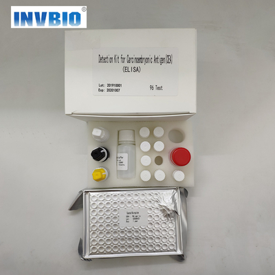 Bộ xét nghiệm HAV IgM Elisa Bản sử dụng cho người 96 phép thử trên mỗi hộp