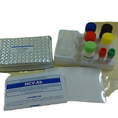 Interleukin 1 Bộ dụng cụ phát hiện elisa beta Human Il1b Elisa Kit Sử dụng